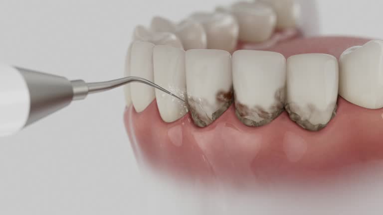 Trusted Tooth Extraction service in Gordonsville, TN - Dentist Open Now